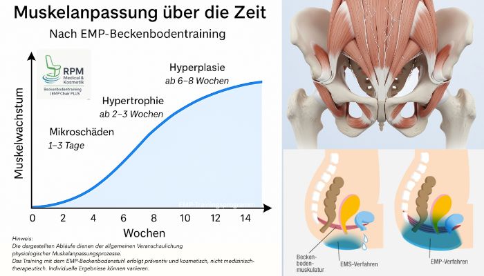 Muskelaufbau-Diagram