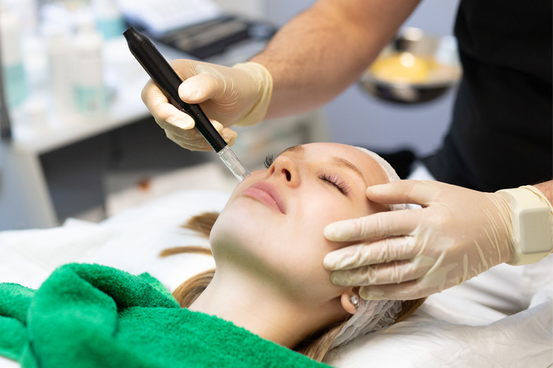 FUSION-Microneedling-Behandlung für eine Hautbildverbesserung im Gesicht